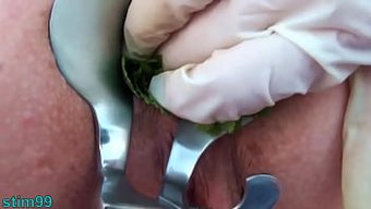 Nettles'In Kıçı Yumruklanıyor Ve Daha Fazla Zevk Için Bir Spekulum Sokuluyor.