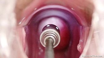 Sarışın Bebek, Yakın Çekimle Tuhaf Bir Tıbbi Prosedürden Geçiyor